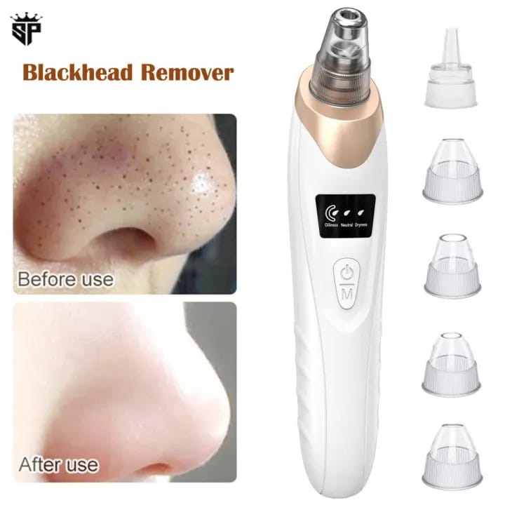 Electric Blackhead Remover